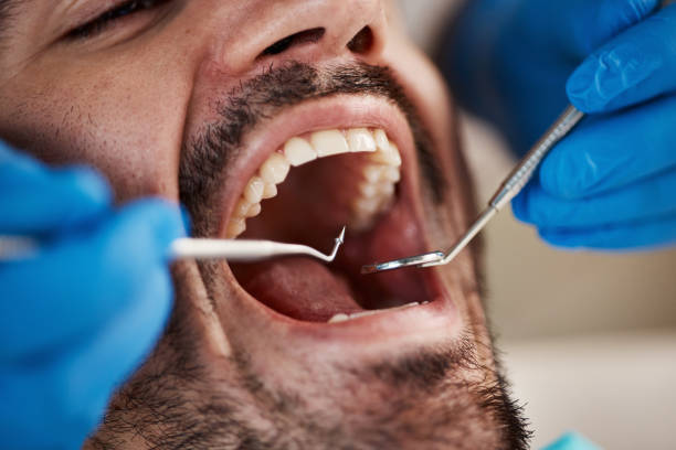 Best Emergency Root Canal Treatment in North Brooksville, FL